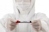 Naučnici tvrde: Još jedan element pomaže u borbi protiv koronavirusa
