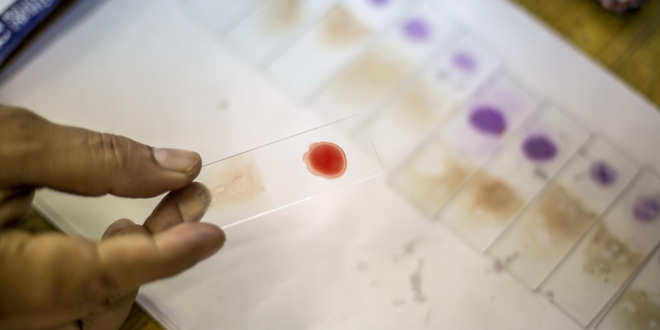 Naučnici uspešno eliminisali HIV iz DNK miša