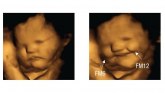 Nauka: Nerođene bebe se smeškaju” šargarepi i mršte” kelju, pokazalo je istraživanje