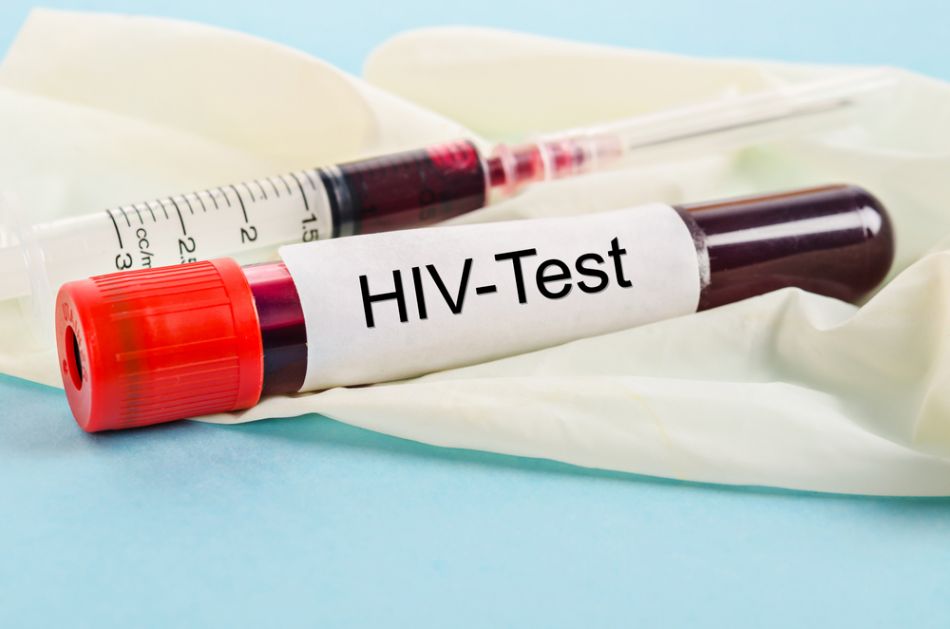 Nazire li se kraj HIV-u i AIDS-u?