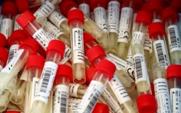 
					Nemačka: 1.045 slučajeva koronavirusa, najviše u poslednja tri meseca 
					
									