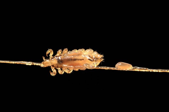 Otkriven neobičan izvor drevne ljudske DNK: Dovoljna je samo šaka gnjida