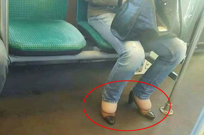 Noga lička, a cipela bečka: Bosanka obula cipele tri broja manje (FOTO)