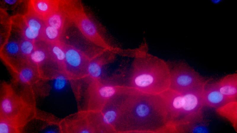 Nova metoda lečenja raka - testiranje DNK malignih ćelija
