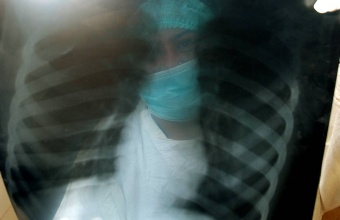 Novi grip ubija oštećujući pluća