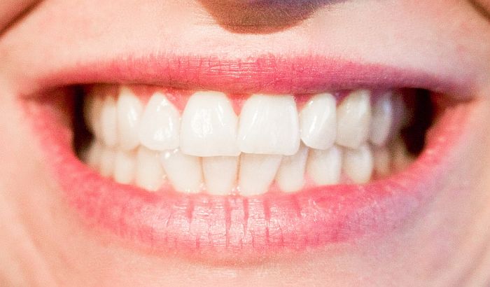 Obeležavanje Nedelje zdravih zuba u utorak u Univeru na Spensu