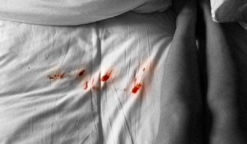 Objavila je fotografiju svoje menstrualne krvi i svim muškarcima poslala BRUTALNU poruku (FOTO)