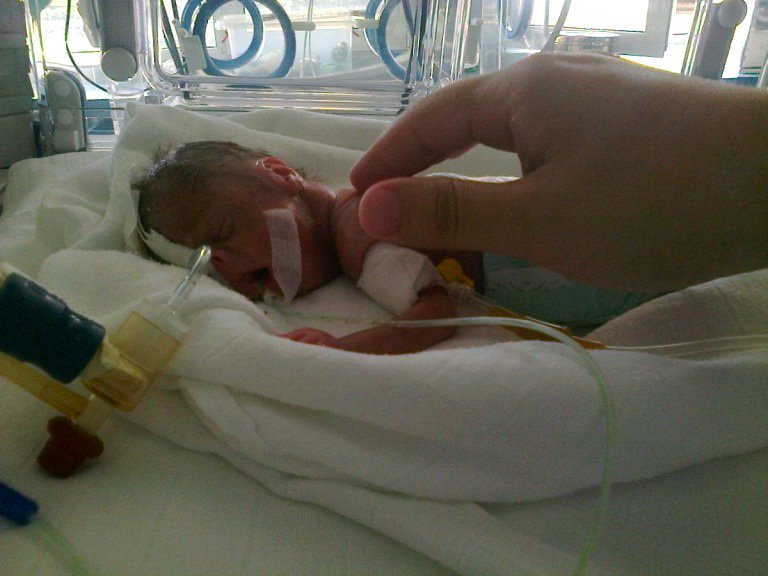 Od 470 grama na rođenju do rušenja lekarskih prognoza: Vuk Grujičić i njegova porodica ne odustaju, uprkos brojnim dijagnozama