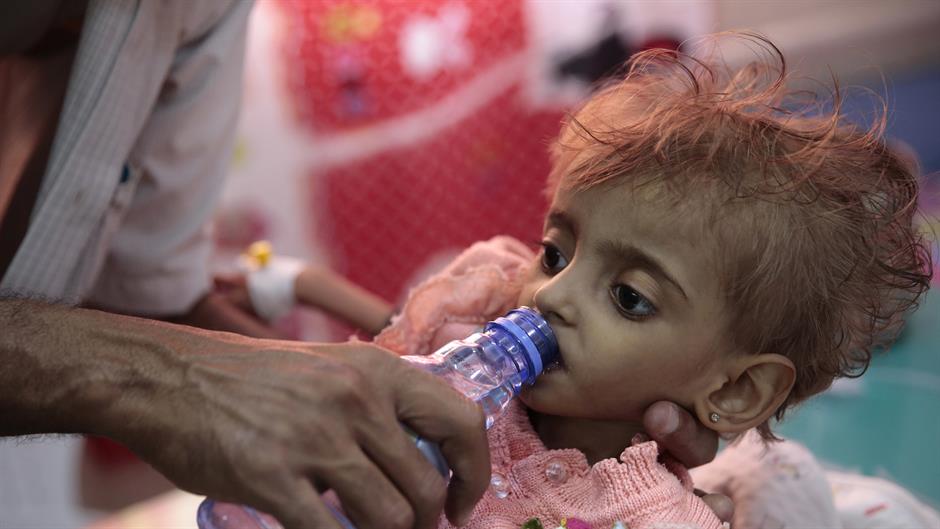 Od gladi umrlo 85.000 dece do pet godina u Jemenu