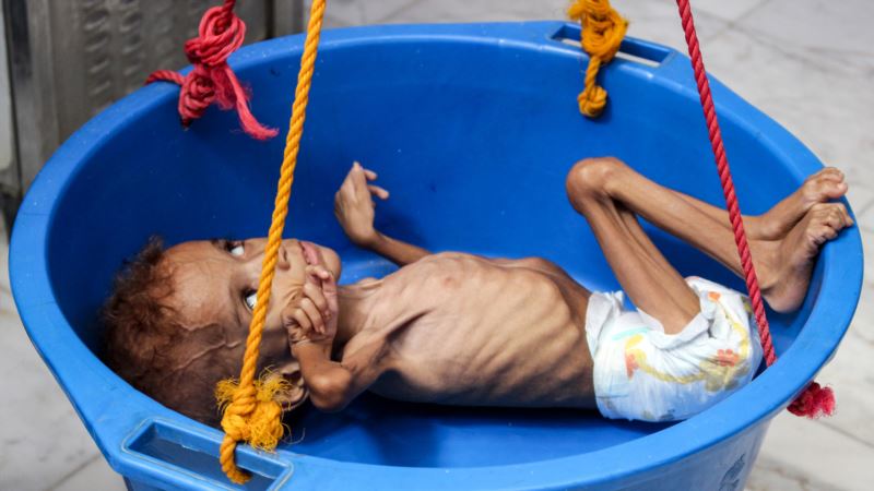 Oko 85.000 djece vjerojatno umrlo od gladi u Jemenu