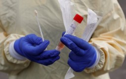 
					U Srbiji 72 osobe zaražene korona virusom 
					
									