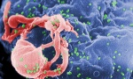 Ostvaren napredak u istraživanju lečenja HIV-a i AIDS