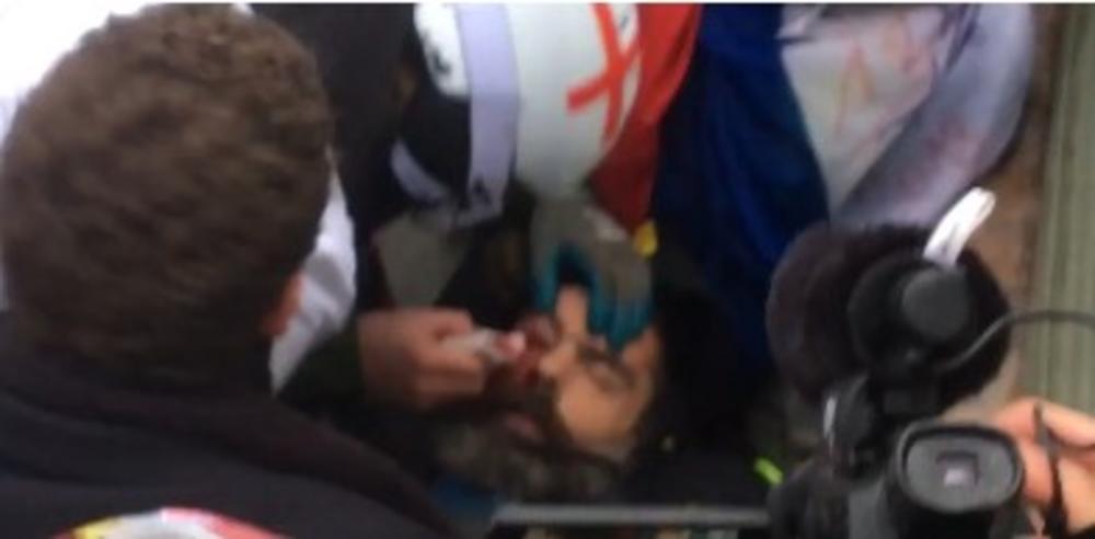 PONOVO PALA KRV U PARIZU: U sukobu sa policijom povređen jedan od lidera Žutih prsluka! (VIDEO)