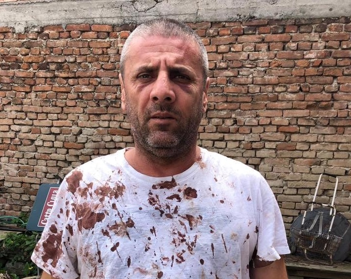 PRETUČEN EDIN HADŽOVIĆ – Novi slučaj nasilja policije u Novom Pazaru