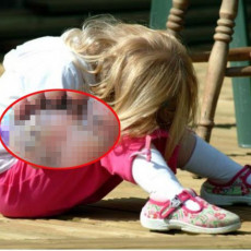 Parazit iz Amerike pojeo devojčicina stopala: Odlazak na OVO MESTO ju je mogao koštati života (FOTO)