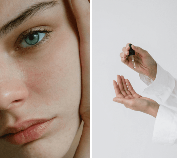 Peptide Overload se zaista događa: Koliko peptida je previše?