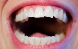 
					Pet načina da izbelite vaše zube 
					
									