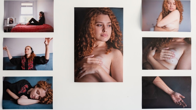 Pitanje života a ne politike: U Crnoj Gori pokrenuta inicijativa za mjere u borbi protiv raka dojke