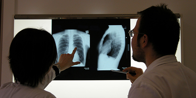 Po broju umrlih od raka pluća Srbija druga u Evropi