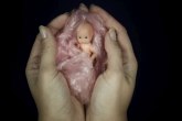 Ovako izgleda abortus u zemljama u kojima je zabranjen