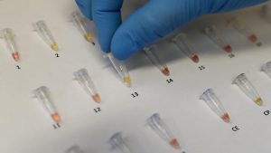 Profesorka Hemijskog fakulteta: U Srbiji se razvija domaći antigenski test na korona viru