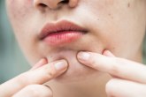 Promene na koži su često znak ozbiljnih bolesti: Osipi, crvenilo, bubuljice   ne ignorišite ih