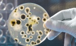 Pronađen lek protiv bakterija otpornih na antibiotike?