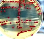Pronađen lek protiv bakterija otpornih na antibiotike?
