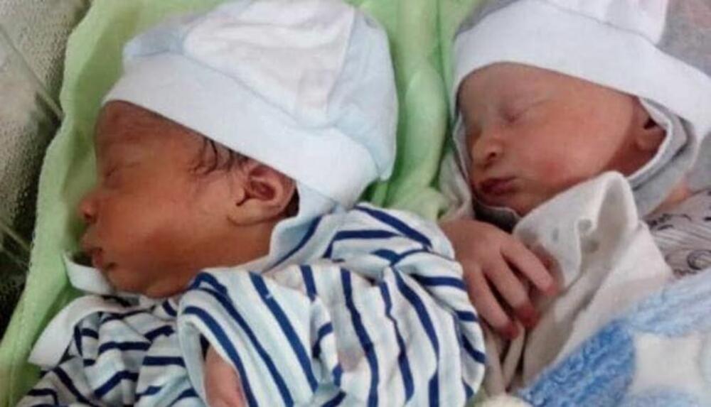 Četvrti put u svetu: Žena s „pola“ srca rodila zdrave blizance