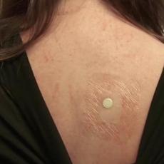 RAZLOG JE VEOMA OZBILJAN: Zalepili su joj bateriju na leđa, kada vidite zašto URADIĆETE ISTO! (VIDEO)