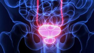 Rak prostate: Koji su simptomi i kako se leči