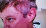 Rane na licu doktora Stevanovića: Nadamo se da ćete kada vidite ove ožiljke ostati kod kuće (FOTO)