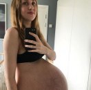 Rodila je trojke i pokazala stomak pre i posle porođaja: Razočarana sam