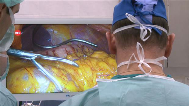 Ruski hirurg laparoskopski operiše karcinom pankreasa u KCS