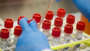 Ruski naučnici mogu do leka za korona virus za 30 dana od krvi ljudi koji su ozdravili