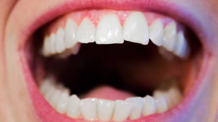 SAZNAJTE KOLIKO DUGO ĆETE ŽIVETI: Stanje zuba određuje DATUM SMRTI