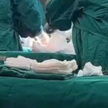 SKANDAL POTRESA SRBIJU! Zaposlena u Narodnom frontu snima gole žene tokom operacije, pa prenosi UŽIVO na mrežama (FOTO/VIDEO)