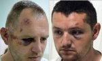 SUD U SEVERNOJ MITROVICI ODLUČIO: Uhapšeni Srbi pušteni da se brane sa slobode; Povređeni prevezeni u KBC (FOTO)