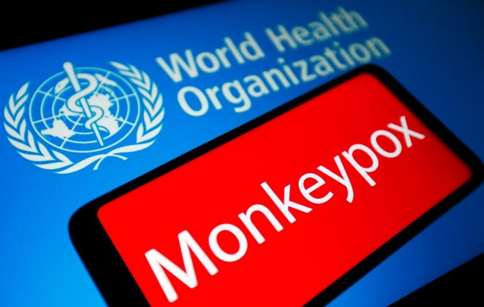 SVETSKA ZDRAVSTVENA ORGANIZACIJA UMERENO OPTIMISTIČNA: Nije verovatno da će majmunske boginje prerasti u pandemiju