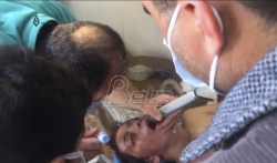 SZO zabrinuta zbog hemijskog napada u Siriji
