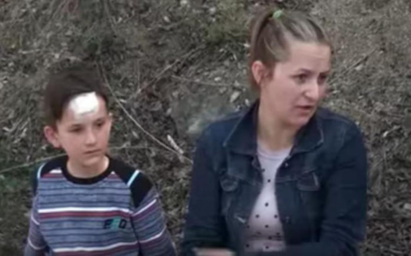 Samohrana majka Daniela besna: Nastavnik je raskrvario glavu mog sina  i zalepio ga za zid, direktorka rekla da se to dešava (FOTO) (VIDEO)