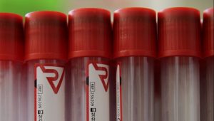 Satler uručio RS više od 22 hiljade PCR testova