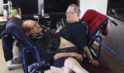 Sijamski blizanci s najdužim životnim vekom umrli u 69. godini