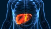 Simptomi su neprimetni, a može biti opasno: Nutricionistkinja otkriva sve o masnoj jetri