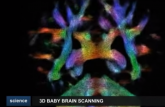 Skeniranje mozga bebe otkriva bilione neuronskih veza