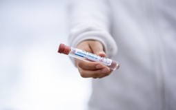 
					Skok broja zaraženih koronavirusom u Novom Pazaru 
					
									