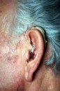 Slušni aparat smanjuje rizik od demencije?