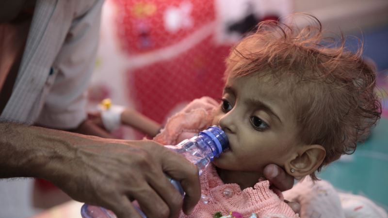 Smanjen uvoz hrane u Jemen, milioni bi mogli da umru od gladi