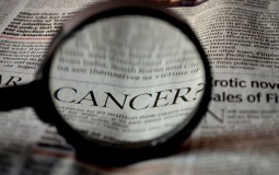 
					Srbija na vrhu liste smrtnosti od melanoma u Evropi 
					
									