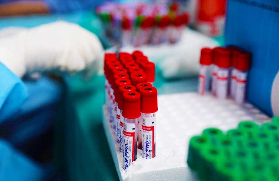Srpski test na virus korona očekuje se do jeseni